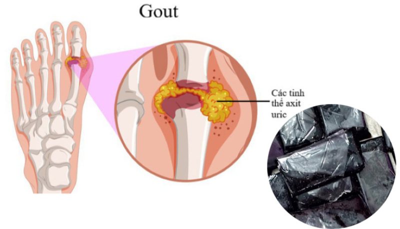 Những tác dụng hữu hiệu của cao gắm