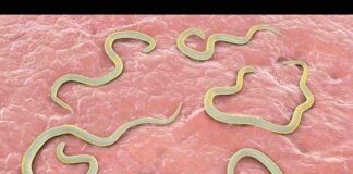 Giun kim là gì và những tác hại gây ra cho con người Giun kim loài ký sinh trùng sống ở đường ruột gây bệnh nguy hiểm