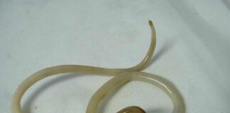 Giun đũa – Cách nhận biết và điều trị bệnh ký sinh Giun đũa thường có thân hình dài đầu và đuôi có hình chóp